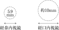 経鼻内視鏡：5.9mm/経口内視鏡：約10mm